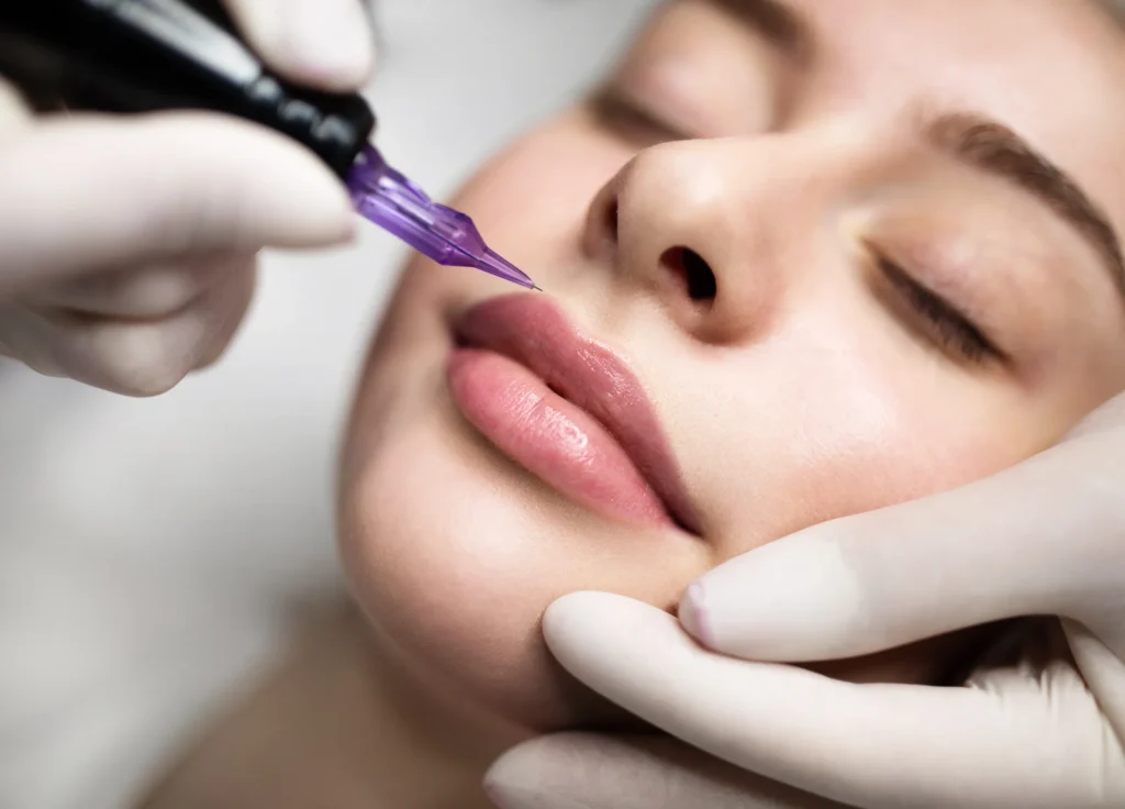 lip tattoo vs filler Calgary,