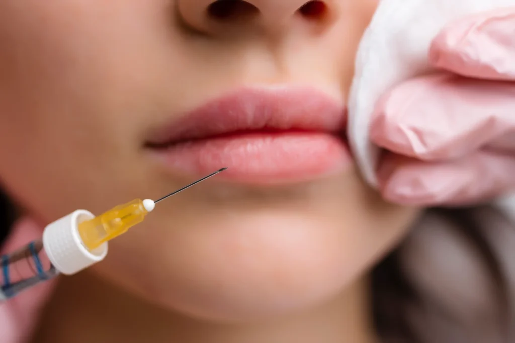 lip enhancement Calgary
