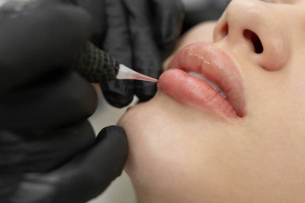 lip blush vs filler Calgary