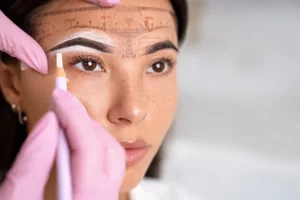 brow mapping Calgary