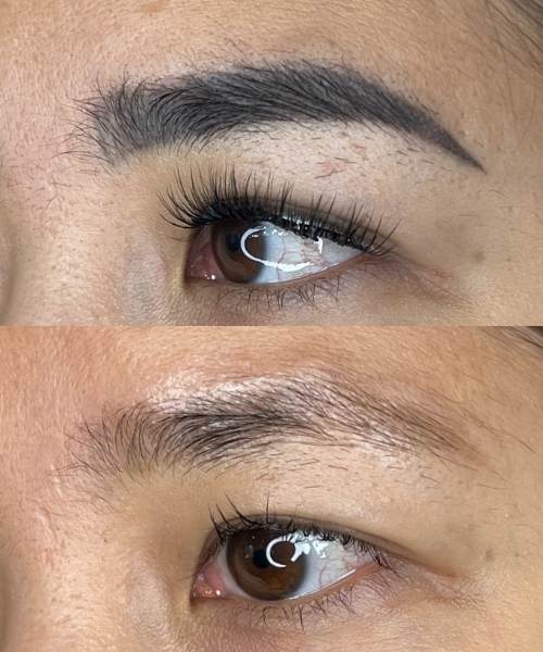 Laser Tattoo / PMU Removal Experience effortless beauty with perfectly framed brows that last up to two weeks through our no-commitment, professional services.