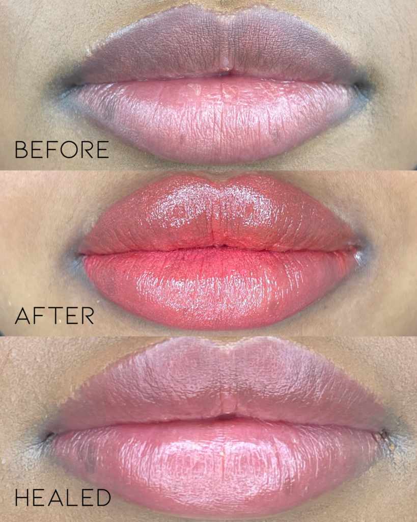 Dark Lip Neutralization & Lip Blush Healing Process